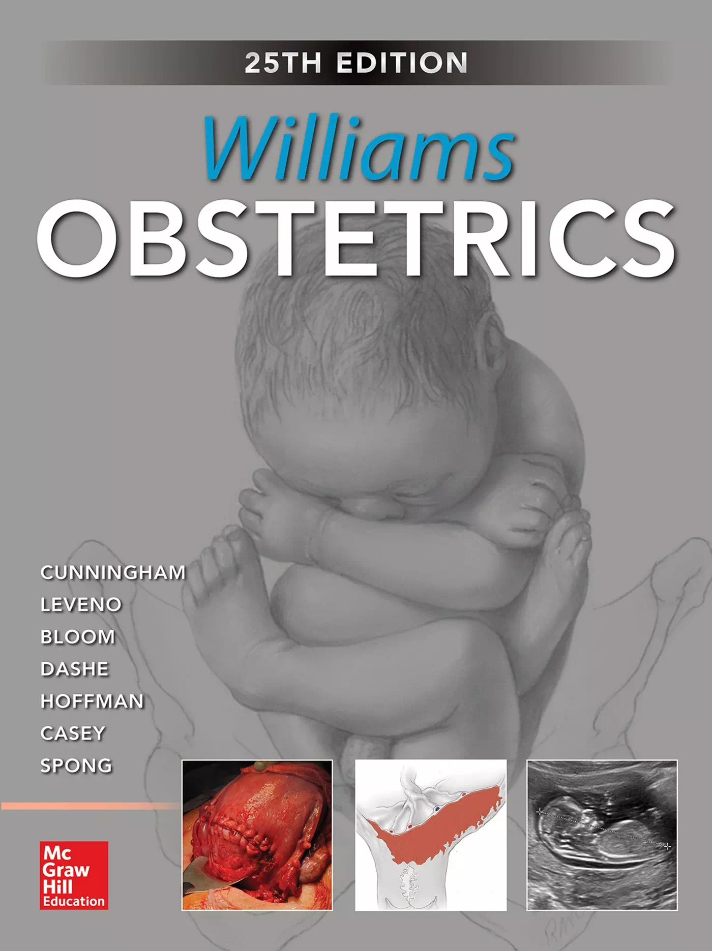 Williams Obstetrics 25e - Gary Cunningham